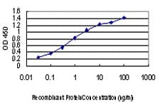 TTN / Titin Antibody (clone 6H5)