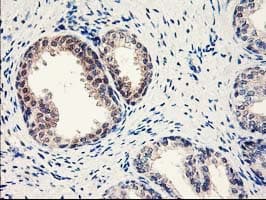Monoclonal Mouse anti-Human NUBPL Antibody (clone OTI3D11, aa1-250, IHC, WB)