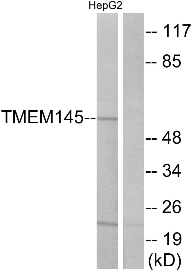 IHC-plus™ Polyclonal Rabbit anti-Human TMEM145 Antibody (aa58-107, IHC, WB)