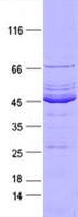 Human FGFR2 / FGF Receptor 2 Protein (Recombinant DDK,C-terminus)