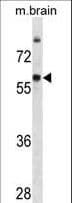 Monoclonal Mouse anti-Human GAD65 Antibody (aa445-473, WB)