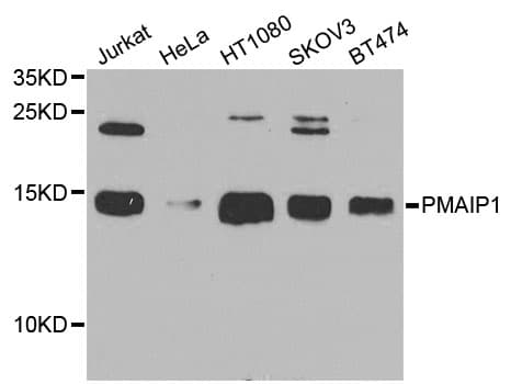 IHC-plus™ PMAIP1 / NOXA Antibody