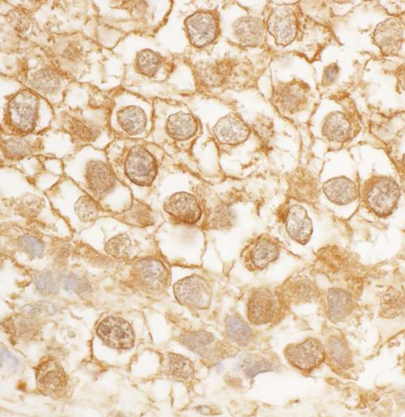 CDC42EP4 / BORG4 Antibody (aa250-300)