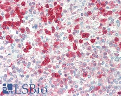 IHC-plus™ G6PD Antibody (aa50-100)