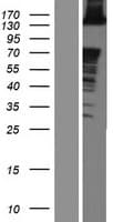 ABL2 Protein (Over-Expression Lysate Myc-DDK (Flag))
