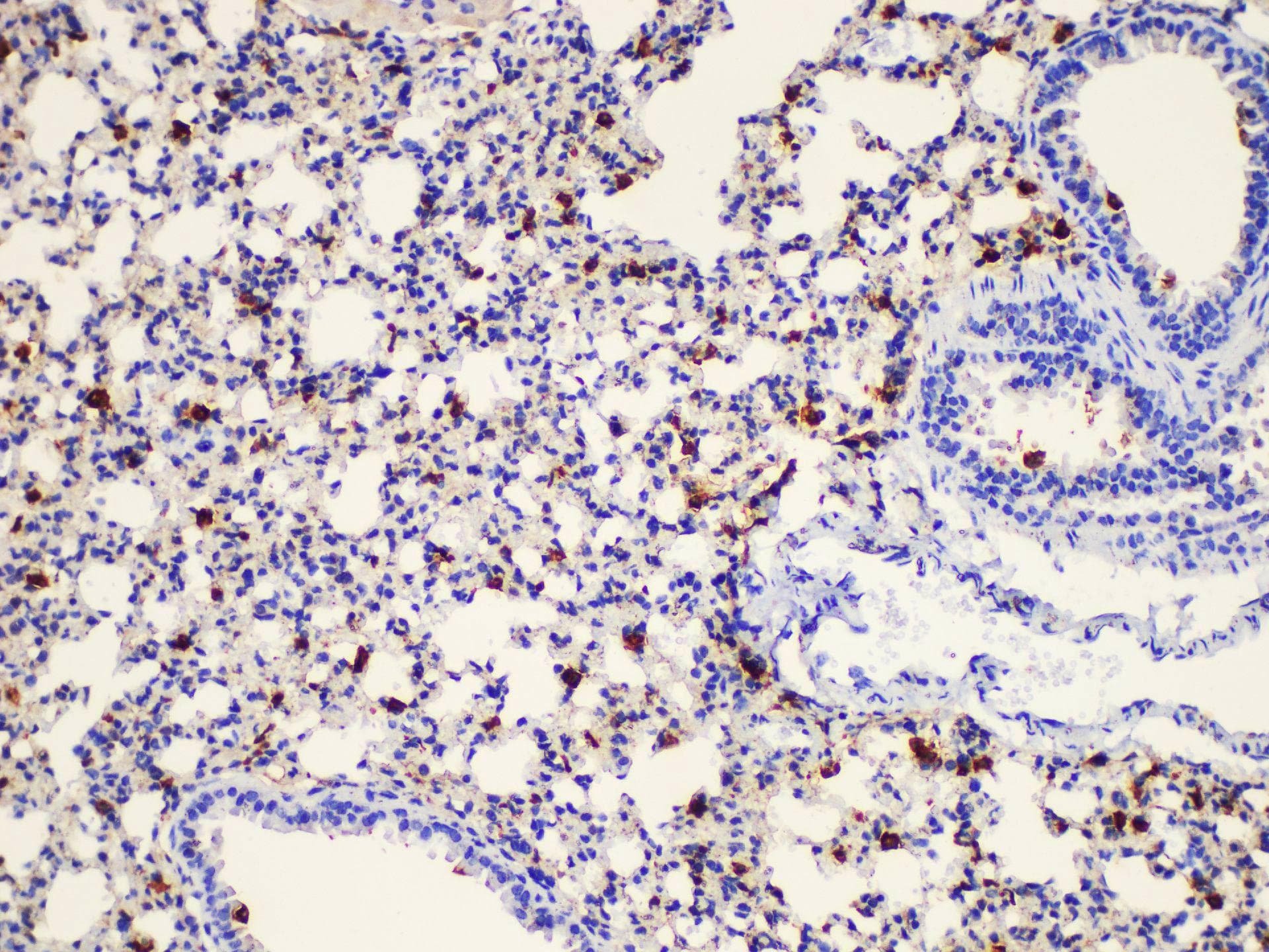 LGALS3 / Galectin 3 Antibody