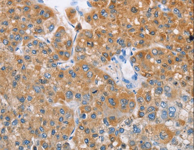 SDR9C1 / BDH1 Antibody