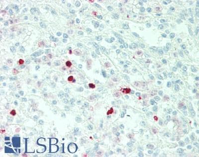 IHC-plus™ TBX1 Antibody (Internal)