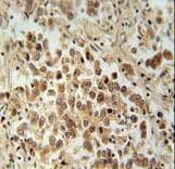 VCX Antibody (aa1-30)