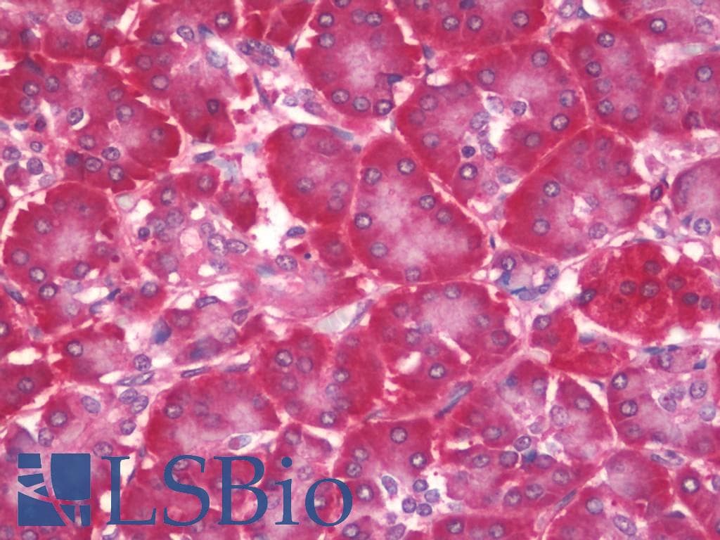 PFDN5 / MM1 Antibody (HRP)
