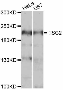 Tuberin / TSC2 Antibody