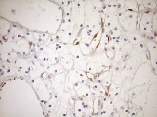 p16INK4a / CDKN2A Antibody (clone OTI3G3)