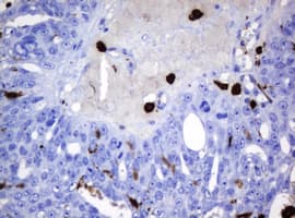HOXD10 Antibody (aa80-340, clone OTI1D11)
