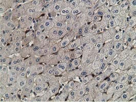 RBP1 / CRBP Antibody (clone OTI2H3)