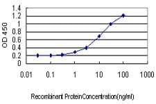 RPL10 / Ribosomal Protein L10 Antibody (clone 3H7)