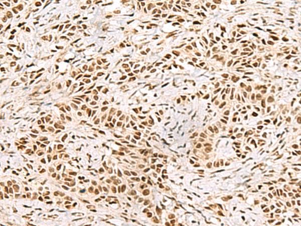 XRCC4 Antibody