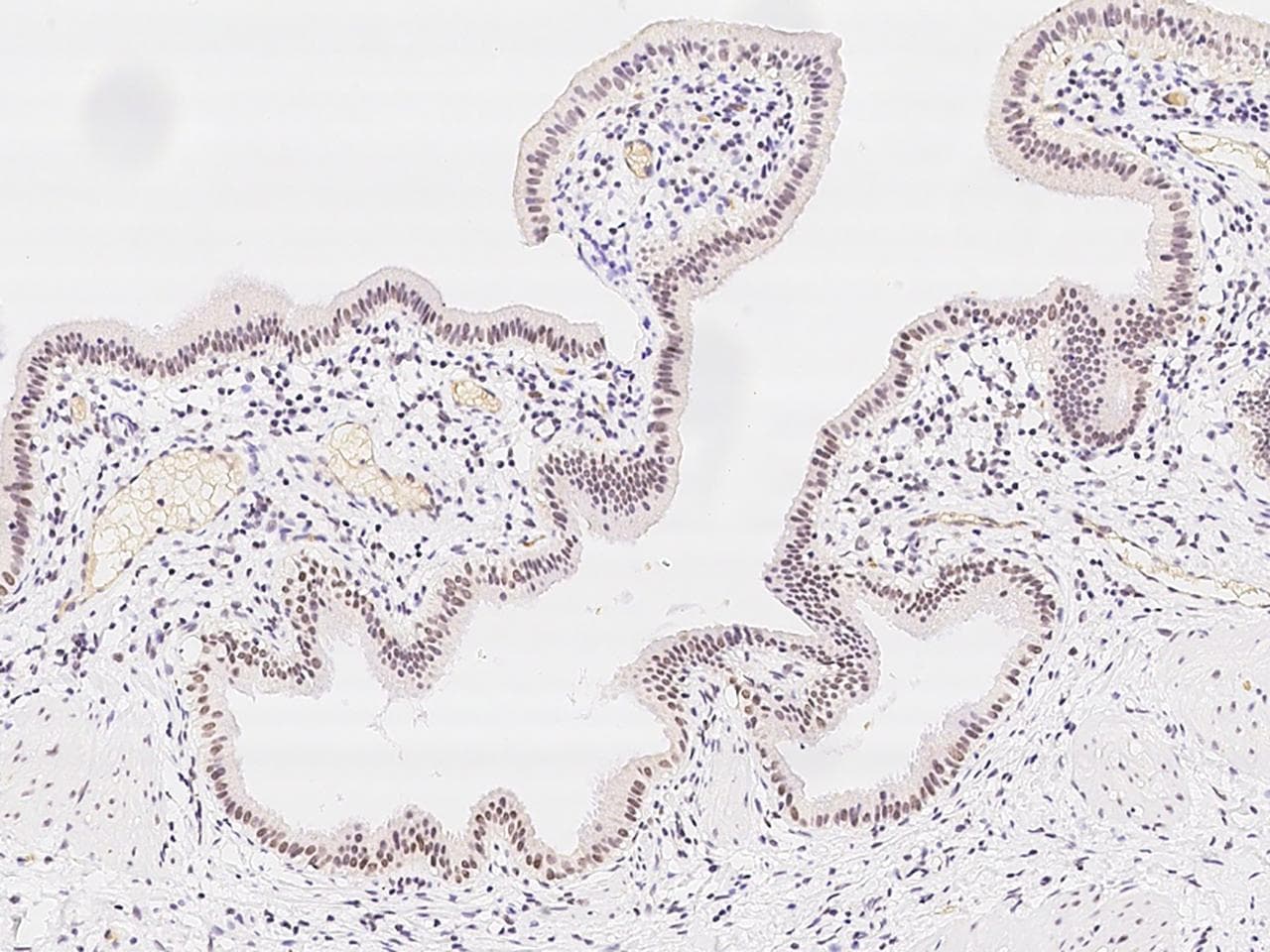 PHTF2 Antibody