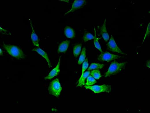 Polyclonal Rabbit anti-Human BECN1 / Beclin-1 Antibody (IHC, IF, WB)