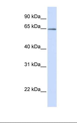 OPTN / Optineurin Antibody (C-Terminus)