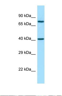 Polyclonal Rabbit anti-Human MMP28 Antibody (aa20-69, WB)