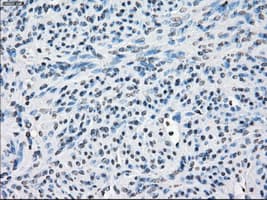 FRA-1 / FOSL1 Antibody (clone OTI12F9)