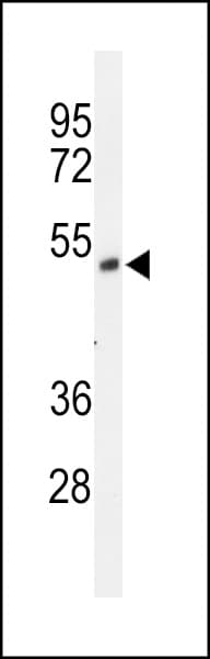 Polyclonal Rabbit anti-Human FOXRED1 Antibody (aa347-377, WB)