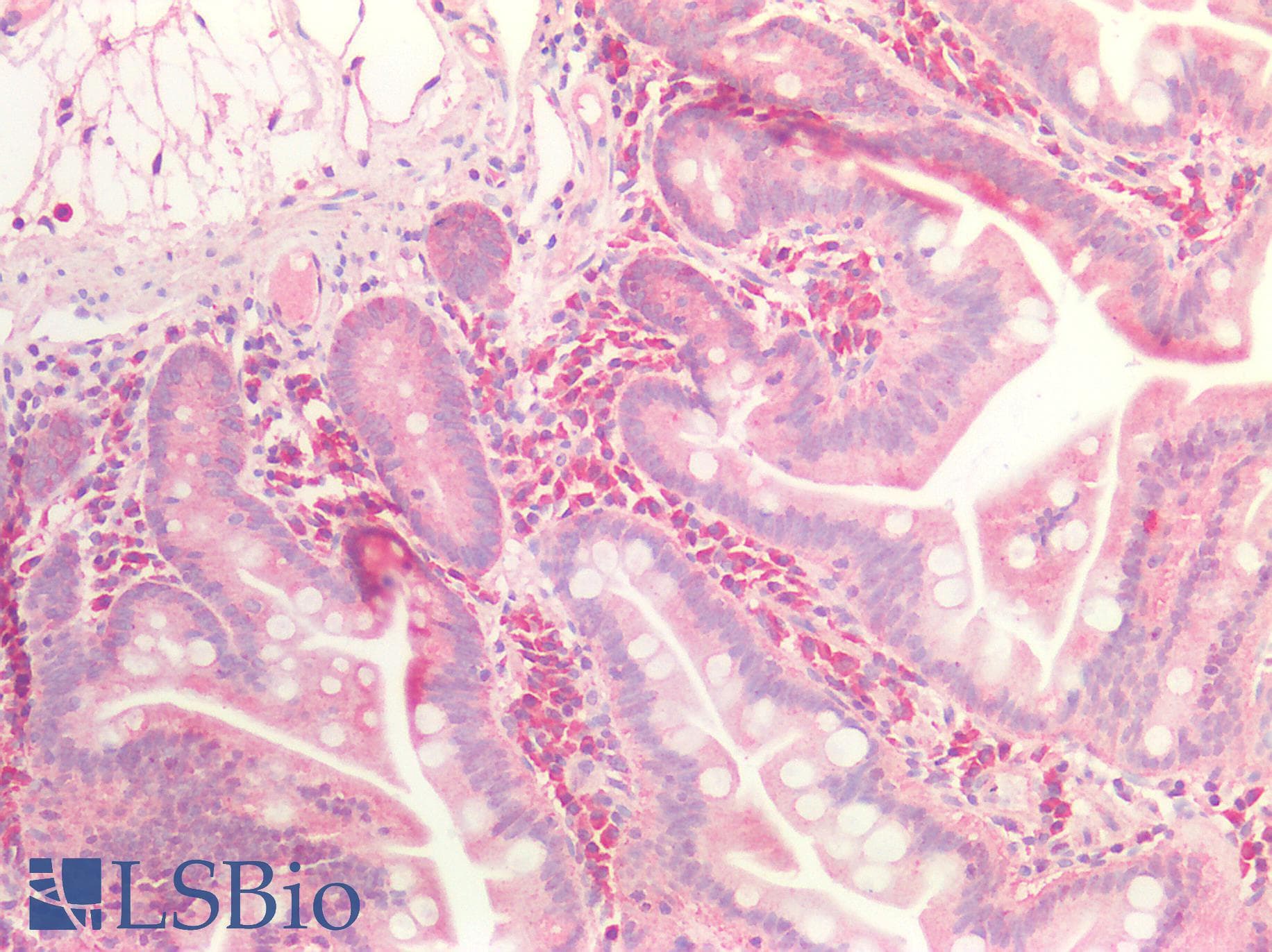IHC-plus™ GMPR1 / GMPR Antibody