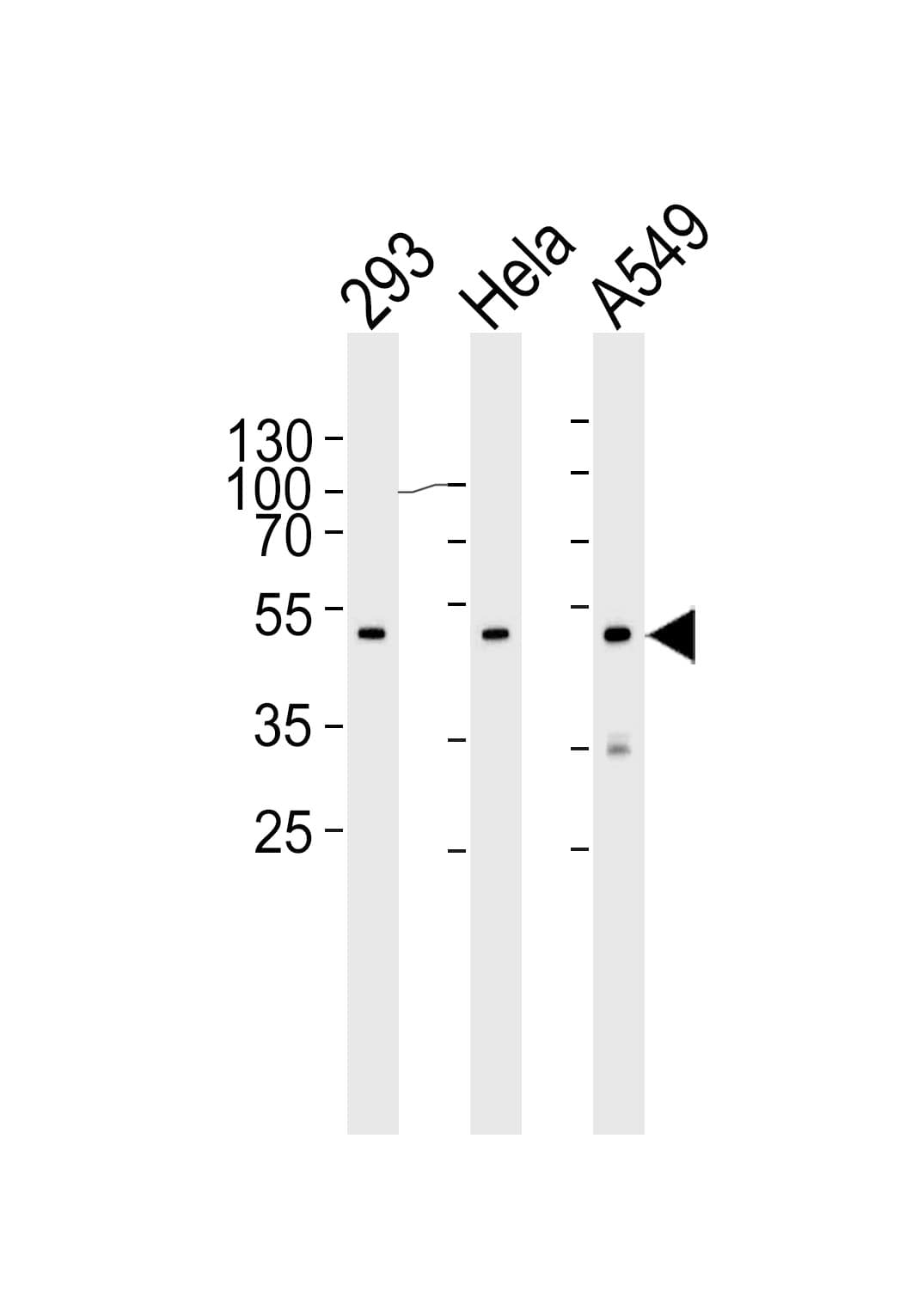 Monoclonal Mouse anti-Human CBX8 Antibody (clone 1214CT171.154.107, C-Terminus, WB)