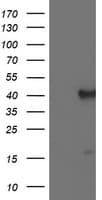 ECI2 / PECI Antibody (clone OTI1H4)