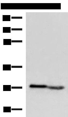 Polyclonal Rabbit anti-Human KLRB1 / CD161 Antibody (IHC, WB)