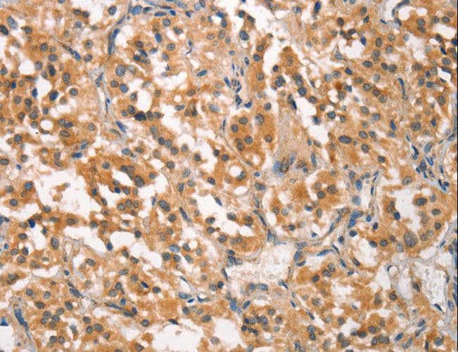 CRKL Antibody