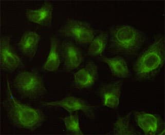 CBR / CBR1 Antibody