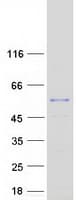 Human NDUFV1 Protein (Recombinant Myc-DDK (Flag))