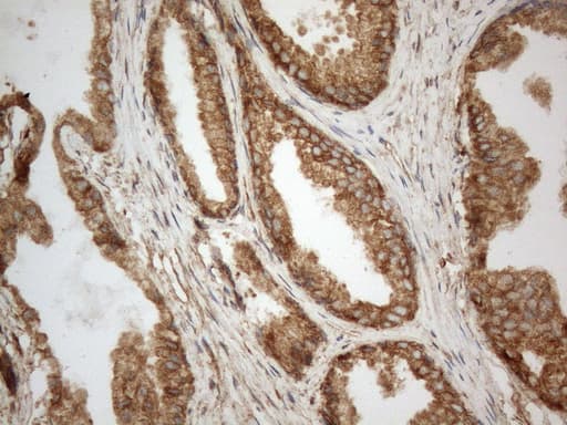 VAP33 / VAPA Antibody (aa2-227, clone OTI10E10)