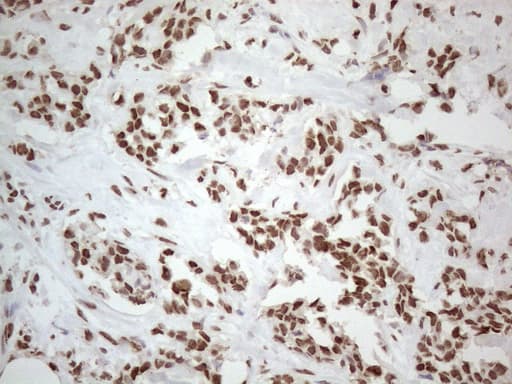 Monoclonal Mouse anti-Human HNRNPL / hnRNP L Antibody (clone OTI4E5, aa270-502, IHC)