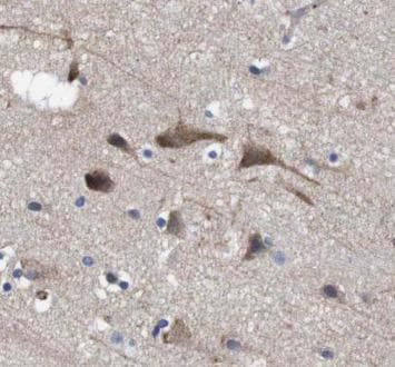 HTT / Huntingtin Antibody