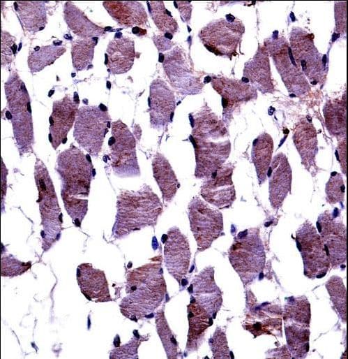 NTRK1 / TrkA Antibody (aa769-796)