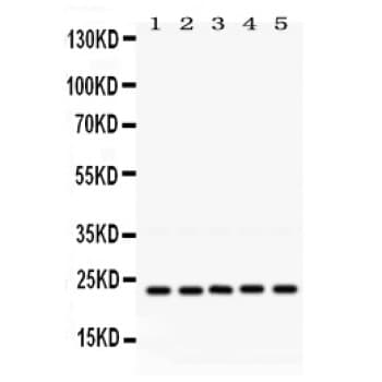 RAB18 Antibody (aa156-192)