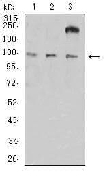ITGAL / CD11a Antibody (clone 5G7C5)