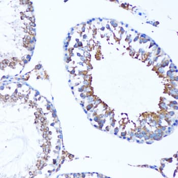 MAP1LC3A / LC3A Antibody