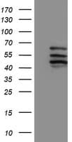 IHC-plus™ CYP2C9 / Cytochrome P450 2C9 Antibody (clone 2C8)