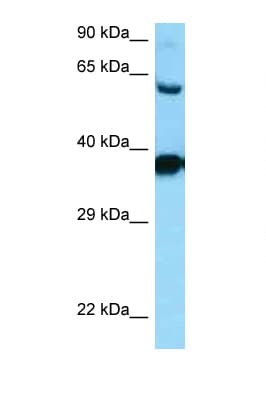 DRD3 / Dopamine Receptor D3 Antibody (aa270-319)