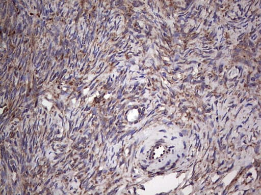 MTDH / Metadherin Antibody (aa70-582, clone OTI1H1)