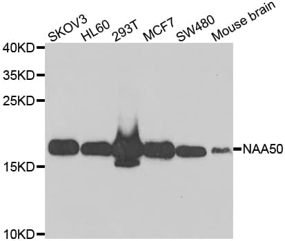 Polyclonal Rabbit anti-Human NAA50 / NAT13 / SAN Antibody (IHC, IF, WB)