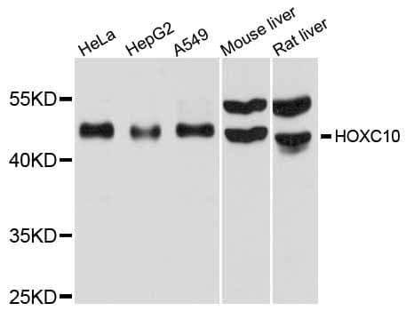 Polyclonal Rabbit anti-Human HOXC10 Antibody (WB)
