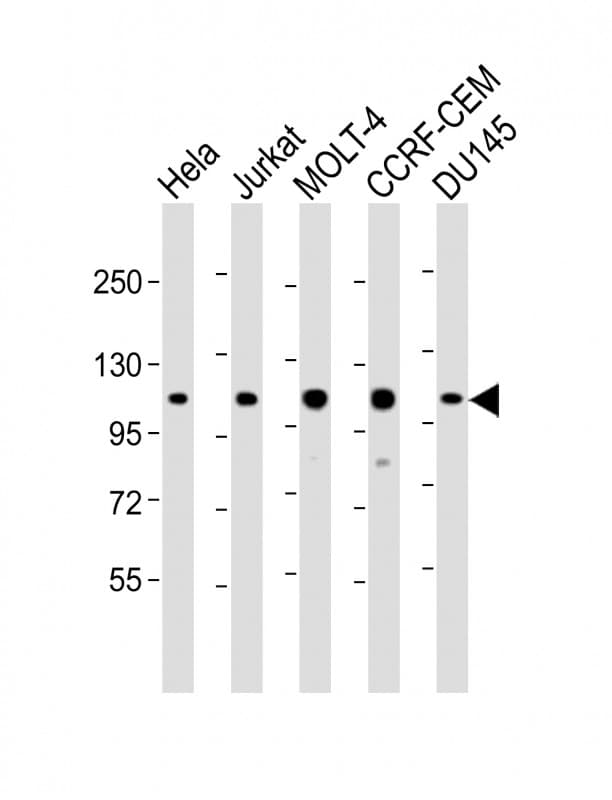 Polyclonal Rabbit anti-Human RAD54B Antibody (aa111-142, WB)