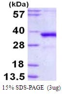 Human POLL / DNA Polymerase Lambda Protein (Recombinant His)