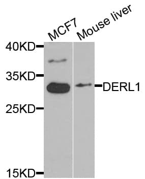DERL1 / Derlin 1 Antibody