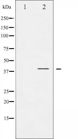 NFKBIA / IKB Alpha / IKBA Antibody (phospho-Tyr305)