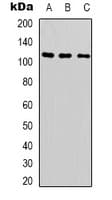 Polyclonal Rabbit anti-Human SUPT16H / FACTP140 Antibody (C-Terminus, IHC, WB)